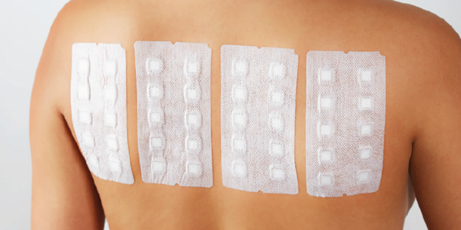 Orientações para o teste de contato - Patch Test