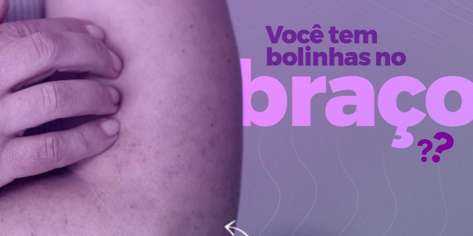 Você tem bolinhas no braço?